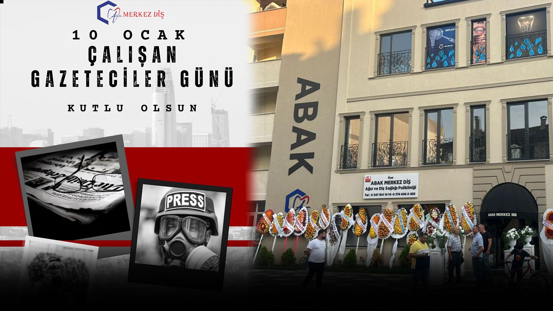 ÇALIŞAN GAZETECİLER GÜNÜNDE ABAK MERKEZ DİŞ POLİKLİNİĞİ'NDEN GAZETECİLERE ÖZEL İNDİRİMLER